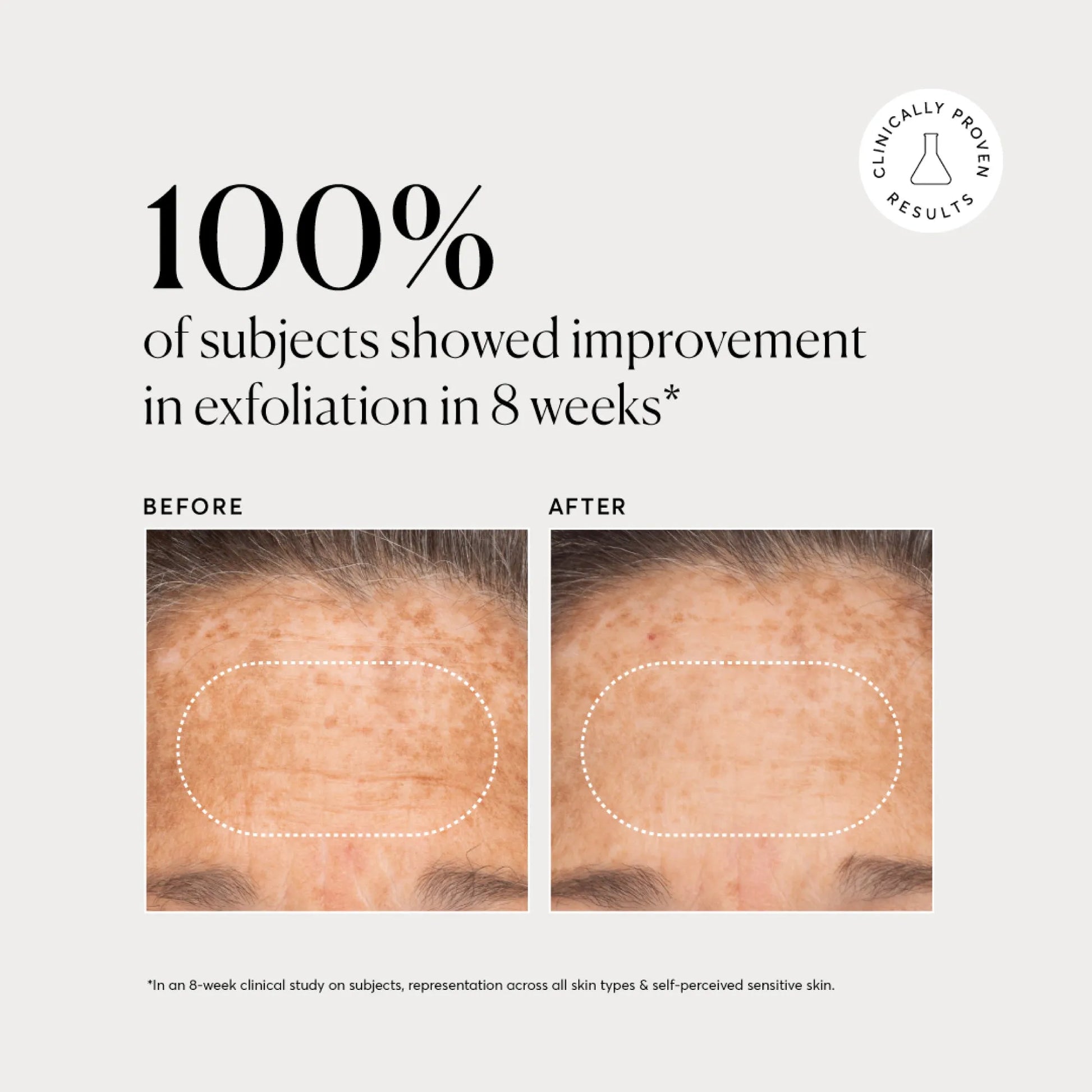 bha-liquid-exfoliant-2-t3 NATR-10027-Alt-Images-BHA-Liquid-Exfoliant-2_-03.webp